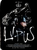 Lupus