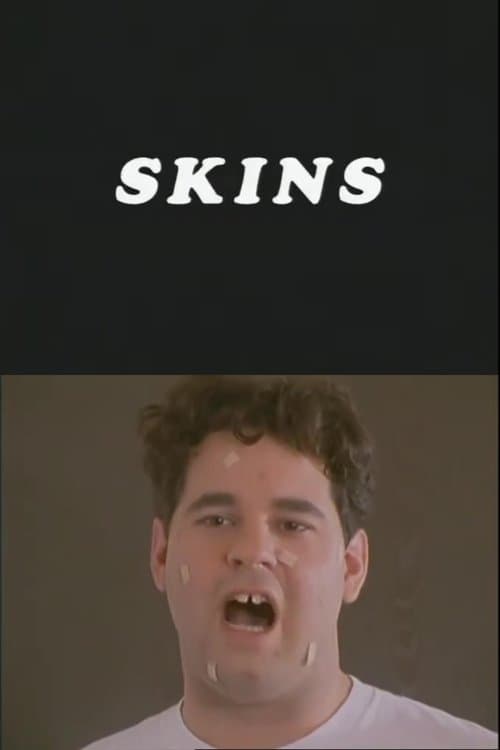 Skinsのポスター