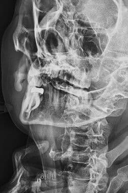 레이のポスター