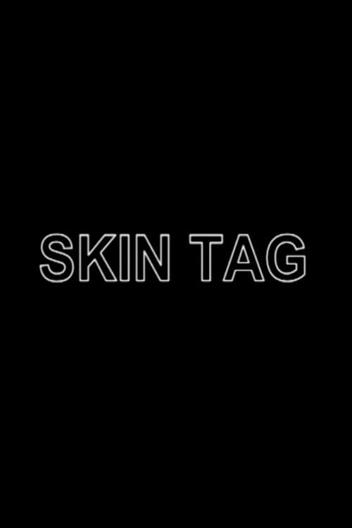 Skin Tagのポスター