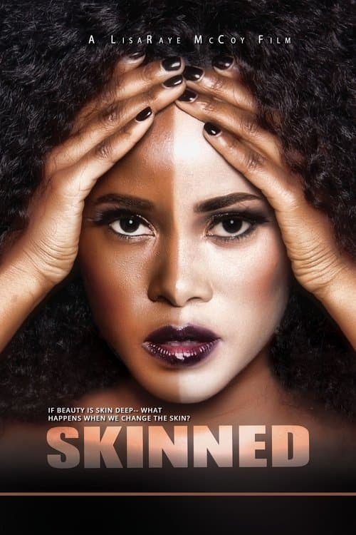 Skinnedのポスター