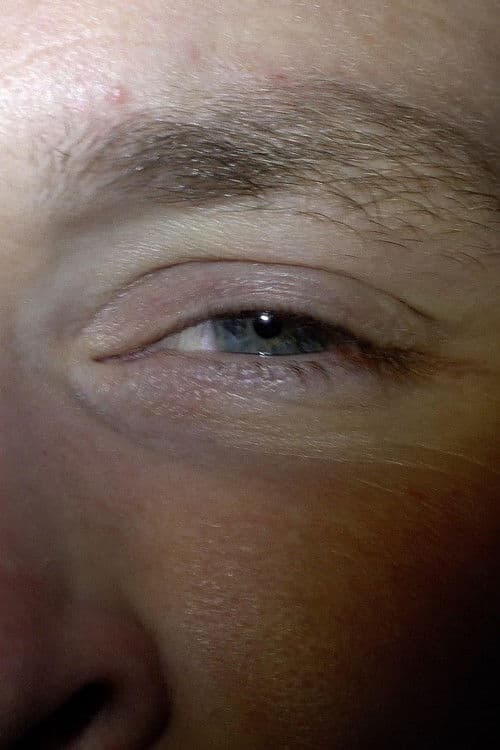 Blinkersのポスター